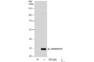 Annexin IV anticorps  (Center)