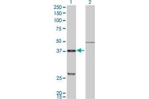 Image no. 4 for anti-Cathepsin K (CTSK) (AA 220-329) antibody (ABIN514786)