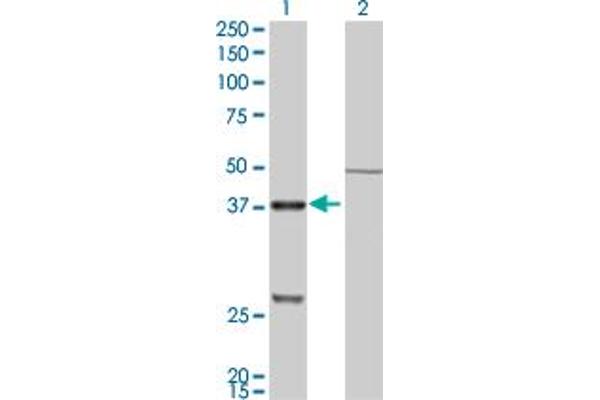 Cathepsin K antibody  (AA 220-329)