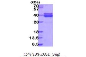 Image no. 1 for 5'-Nucleotidase, Cytosolic III-Like (NT5C3L) (AA 1-300) protein (His tag) (ABIN5853976)