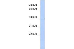 SIRT4 抗体  (Middle Region)