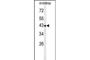 UBXN6 antibody  (C-Term)