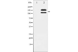 Image no. 7 for anti-Mast/stem Cell Growth Factor Receptor (KIT) (pTyr721) antibody (ABIN6256004)