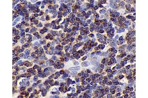 Immunohistochemistry analysis of paraffin-embedded rat lymph node using CD192 Polyclonal Antibody at dilution of 1:300.