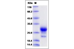 Image no. 1 for Prostaglandin D2 Synthase (PTGDS) (AA 1-190) protein (His tag) (ABIN2005657)