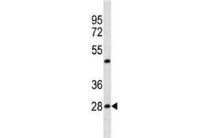 Image no. 3 for anti-Prohibitin (PHB) (AA 92-121) antibody (ABIN3032314)