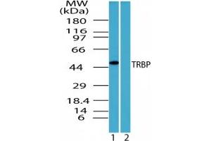 Image no. 3 for anti-TAR (HIV-1) RNA Binding Protein 2 (TARBP2) (AA 340-390) antibody (ABIN207742)