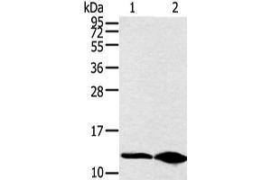 Western blot analysis of Hela cell and human fetal brain tissue using DYNLL2 Polyclonal Antibody at dilution of 1:250