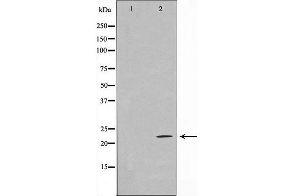 Ephrin A2 anticorps  (N-Term)