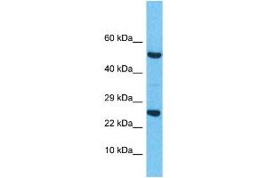 Image no. 1 for anti-Related RAS Viral (R-Ras) Oncogene Homolog 2 (RRAS2) (C-Term) antibody (ABIN2785767)