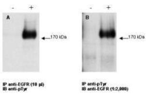 Combined immunoprecipitation and western blot using anti-EGFR antibody.