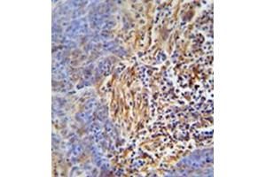 Image no. 1 for anti-Major Histocompatibility Complex, Class II, DR beta 5 (HLA-DRB5) (AA 49-79), (Middle Region) antibody (ABIN952755)