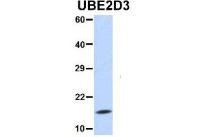 Image no. 5 for anti-Ubiquitin-Conjugating Enzyme E2D 3 (UBE2D3) (N-Term) antibody (ABIN2775674)