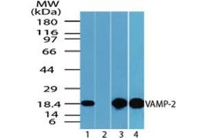 Image no. 1 for anti-Vesicle-Associated Membrane Protein 2 (Synaptobrevin 2) (VAMP2) (AA 1-50) antibody (ABIN960402)