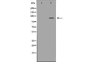 anti-ADAM Metallopeptidase with Thrombospondin Type 1 Motif, 4 (ADAMTS4) (Internal Region) antibody