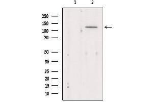 Image no. 2 for anti-Potassium Large Conductance Calcium-Activated Channel, Subfamily M, alpha Member 1 (KCNMA1) (Internal Region) antibody (ABIN6263145)