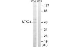 Image no. 1 for anti-serine/threonine Kinase 24 (STK24) (AA 319-368) antibody (ABIN1535332)