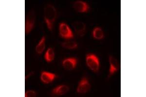Image no. 1 for anti-Fatty Acid Binding Protein 5 (Psoriasis-Associated) (FABP5) (full length) antibody (ABIN6043434)
