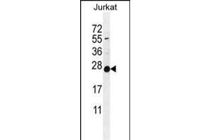 POLR2J Antikörper  (C-Term)