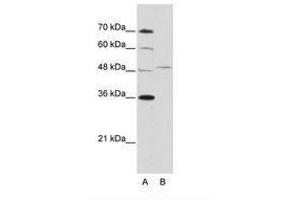 Image no. 2 for anti-Forkhead Box Q1 (FOXQ1) (AA 29-78) antibody (ABIN202435)