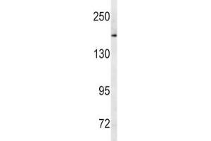 Image no. 1 for anti-ATP-Binding Cassette, Sub-Family C (CFTR/MRP), Member 1 (ABCC1) (AA 1247-1275) antibody (ABIN5647440)