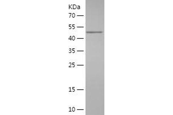 ZEB2 Protein (AA 1012-1214) (IF2DI tag)