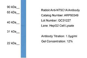 Image no. 2 for anti-5'-Nucleotidase, Cytosolic IA (NT5C1A) (C-Term) antibody (ABIN2788416)