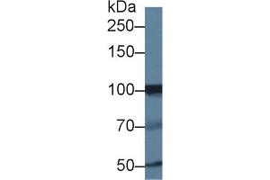 Image no. 1 for anti-Inositol Polyphosphate-4-Phosphatase, Type I, 107kDa (INPP4A) (AA 1-137) antibody (ABIN1868712)