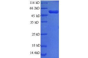 Image no. 1 for phosphoglycerate Dehydrogenase (PHGDH) (AA 2-251), (partial) protein (GST tag) (ABIN1608043)