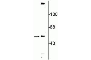 Image no. 1 for anti-Solute Carrier Family 18 (Vesicular Monoamine Transporter), Member 2 (SLC18A2) (C-Term) antibody (ABIN6254015)