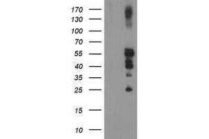Image no. 4 for anti-Protein tyrosine Phosphatase, Non-Receptor Type 1 (PTPN1) antibody (ABIN1500496)