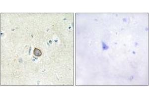Image no. 1 for anti-Cadherin EGF LAG Seven Pass G-Type Receptor 3 (CELSR3) (AA 91-140) antibody (ABIN1534328)
