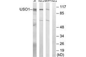 Image no. 1 for anti-USO1 Homolog, Vesicle Docking Protein (USO1) (AA 913-962) antibody (ABIN1534939)