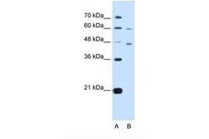 anti-Cysteine-Rich with EGF-Like Domains 1 (CRELD1) (AA 311-360) antibody