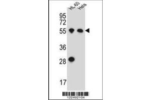 Image no. 1 for anti-Hyaluronan Synthase 2 (HAS2) (AA 138-166) antibody (ABIN651874)