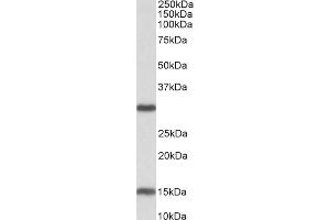 Image no. 2 for anti-Sirtuin 3 (SIRT3) (Internal Region) antibody (ABIN768568)