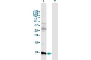 Western Blot analysis of GUCA2B expression in transfected 293T cell line by GUCA2B MaxPab polyclonal antibody.