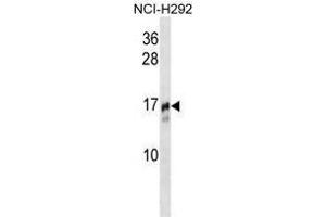 Image no. 1 for anti-Trafficking Protein Particle Complex 2 (TRAPPC2) (AA 10-39), (N-Term) antibody (ABIN955321)