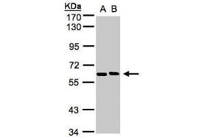 anti-5'-Nucleotidase, Cytosolic II (NT5C2) (Internal Region) antibody