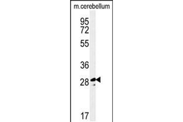 anti-Tescalcin (TESC) (AA 88-116), (C-Term) antibody