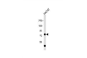Image no. 2 for anti-Tumor Protein P63 (TP63) (AA 651-680), (C-Term) antibody (ABIN657886)