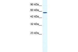 anti-Zinc Finger and BTB Domain Containing 44 (ZBTB44) (C-Term) antibody