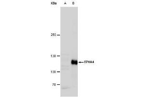 WB Image Eph receptor A4 antibody [N3C2], Internal detects Eph receptor A4 protein by western blot analysis.