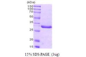 Proliferating Cell Nuclear Antigen (PCNA) (AA 1-261) protein