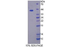 Image no. 1 for Phospholipid Scramblase 4 (PLSCR4) (AA 1-299) protein (ABIN6239437)