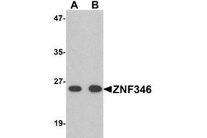 Image no. 1 for anti-Zinc Finger Protein 346 (ZNF346) (N-Term) antibody (ABIN783747)