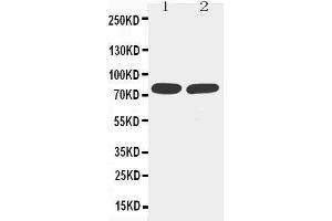 Image no. 1 for anti-Tumor Necrosis Factor Receptor Superfamily, Member 1B (TNFRSF1B) (AA 103-121), (Middle Region) antibody (ABIN3044354)