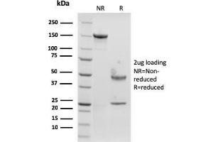 Image no. 1 for anti-CD207 Molecule, Langerin (CD207) (AA 74-213) antibody (ABIN6940245)