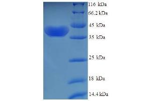 Image no. 1 for Uridine-Cytidine Kinase 1 (UCK1) (AA 1-201), (Isoform 2) protein (His-SUMO Tag) (ABIN5710592)