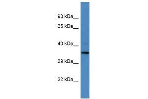 Image no. 1 for anti-MLF1 Interacting Protein (MLF1IP) (N-Term) antibody (ABIN2788059)